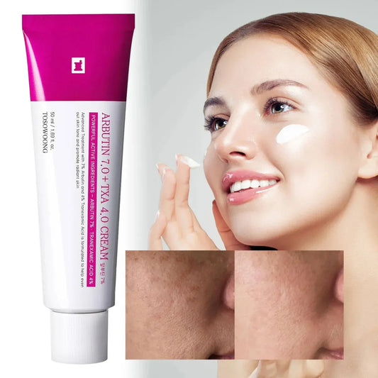✨ Arbutin 7% + Tranexamic Acid 4% Cream ✨