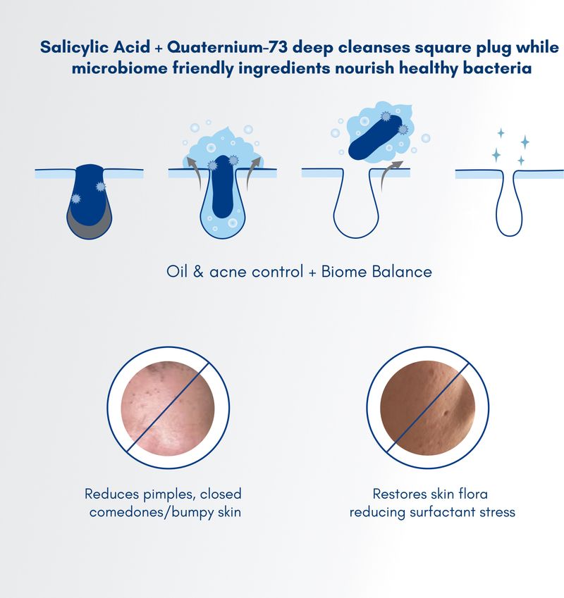 Becalm Airy Face Wash for Oily Skin